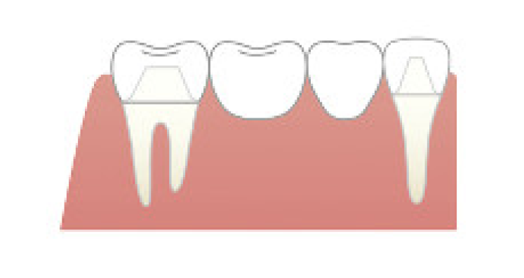 ブリッジ まつだ歯科医院